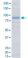 Loading 1 &mu;g protein in SDS-PAGE